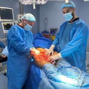 Parathyroid Surgery Baghdad    
