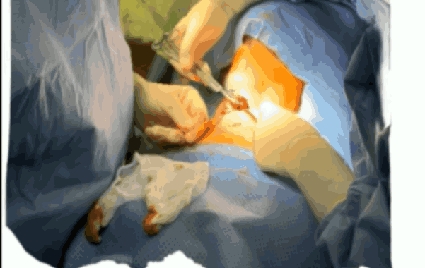 7’s Of Parathyroid Surgery