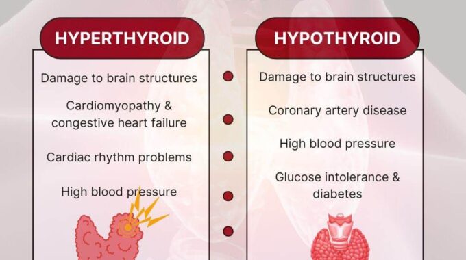 Hypothyroid Vs Hyperthyroid