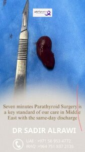 7 Minute Parathyroid Surgery
